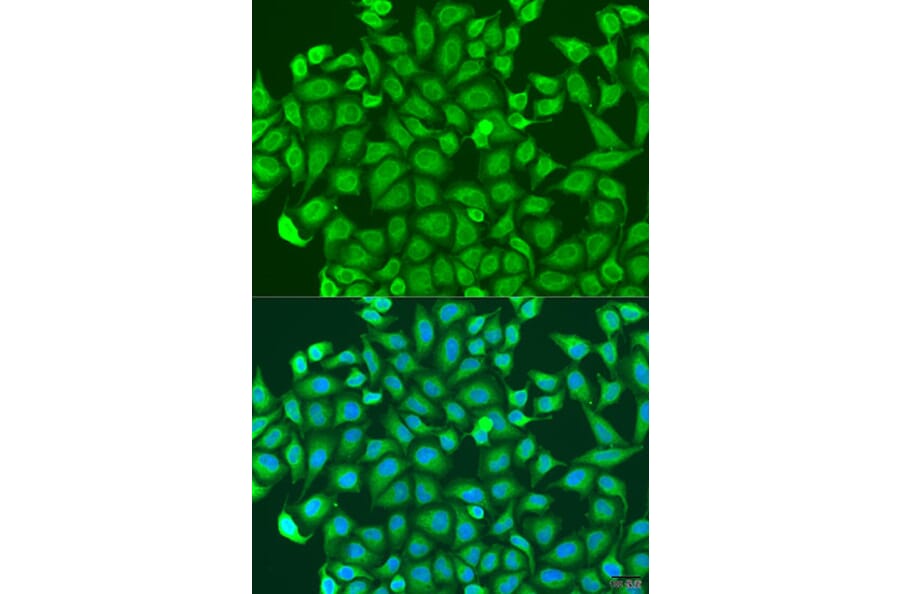 Immunofluorescence - Anti-PCDHA6 Antibody (A17209) - Antibodies.com