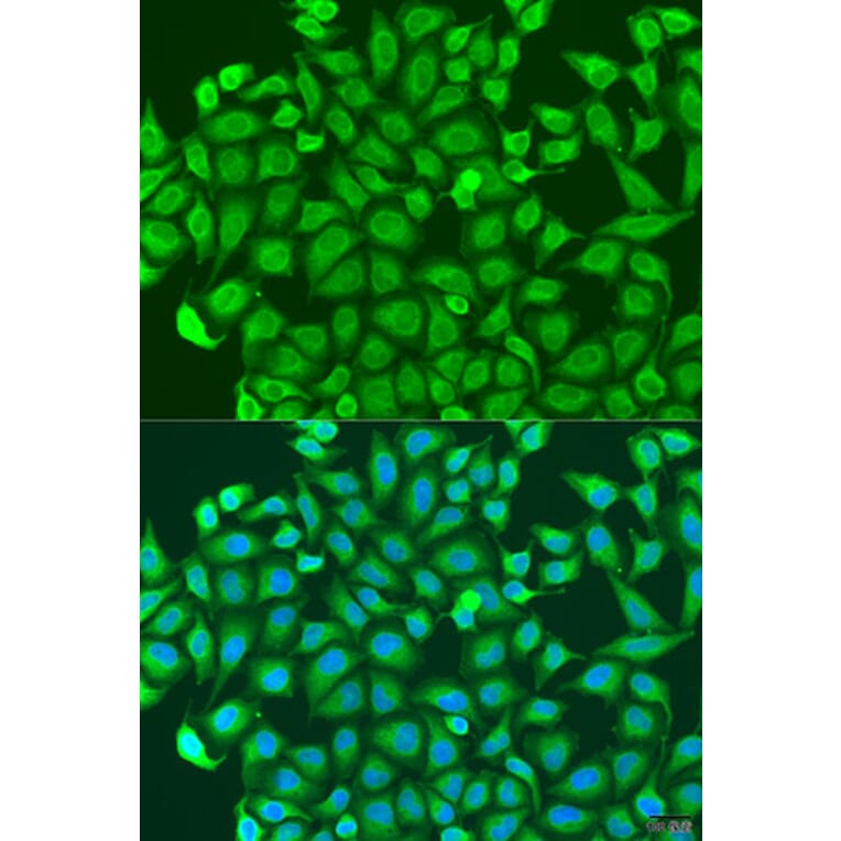Immunofluorescence - Anti-PCDHA6 Antibody (A17209) - Antibodies.com