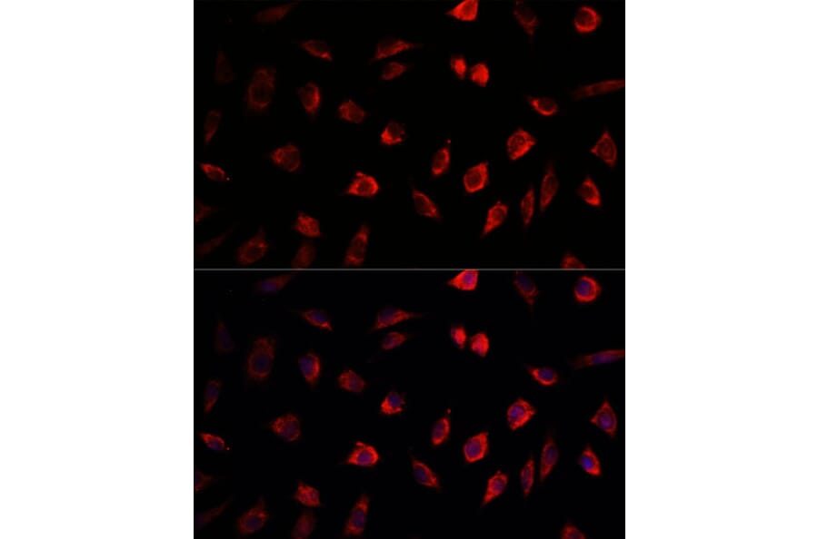 Immunofluorescence - Anti-NEDD1 Antibody (A17211) - Antibodies.com