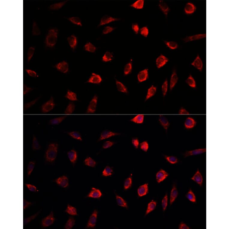 Immunofluorescence - Anti-NEDD1 Antibody (A17211) - Antibodies.com