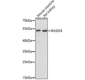 Western Blot - Anti-RASSF6 Antibody (A17212) - Antibodies.com