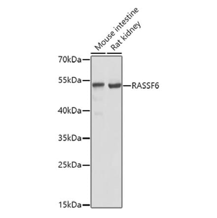 Western Blot - Anti-RASSF6 Antibody (A17212) - Antibodies.com