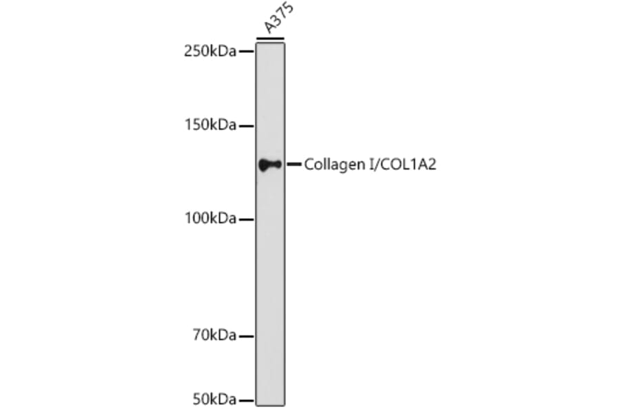Western Blot - Anti-COL1A2 Antibody (A17214) - Antibodies.com