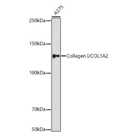 Western Blot - Anti-COL1A2 Antibody (A17214) - Antibodies.com