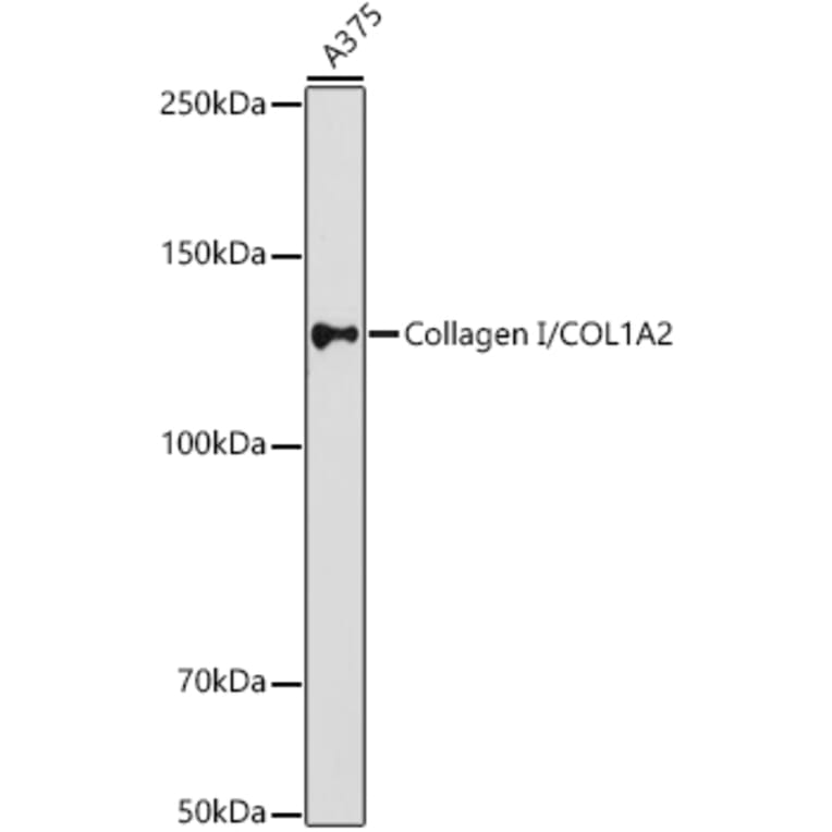 Western Blot - Anti-COL1A2 Antibody (A17214) - Antibodies.com