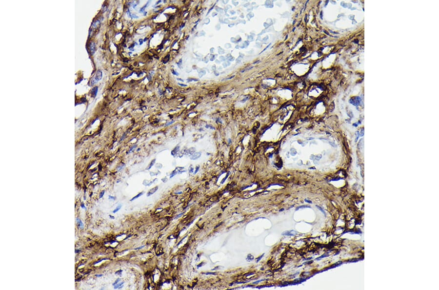 Immunohistochemistry - Anti-COL1A2 Antibody (A17214) - Antibodies.com