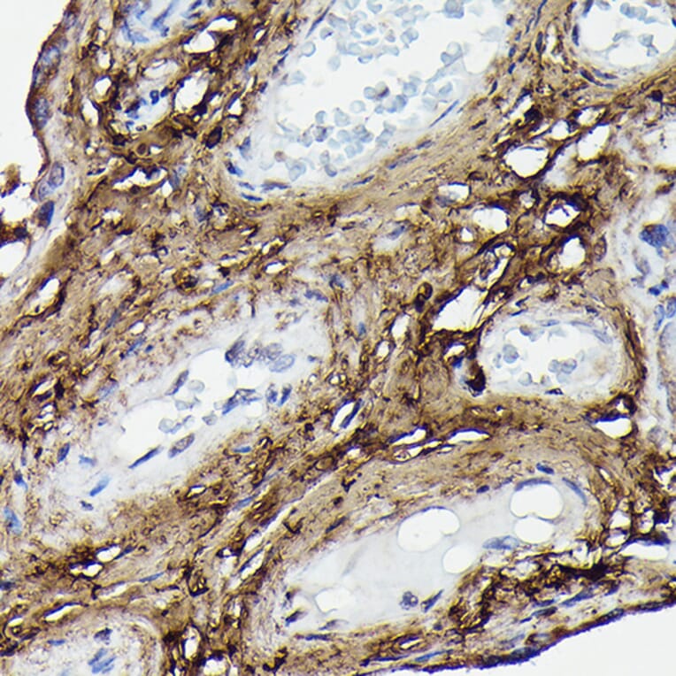 Immunohistochemistry - Anti-COL1A2 Antibody (A17214) - Antibodies.com