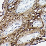 Immunohistochemistry - Anti-COL1A2 Antibody (A17214) - Antibodies.com
