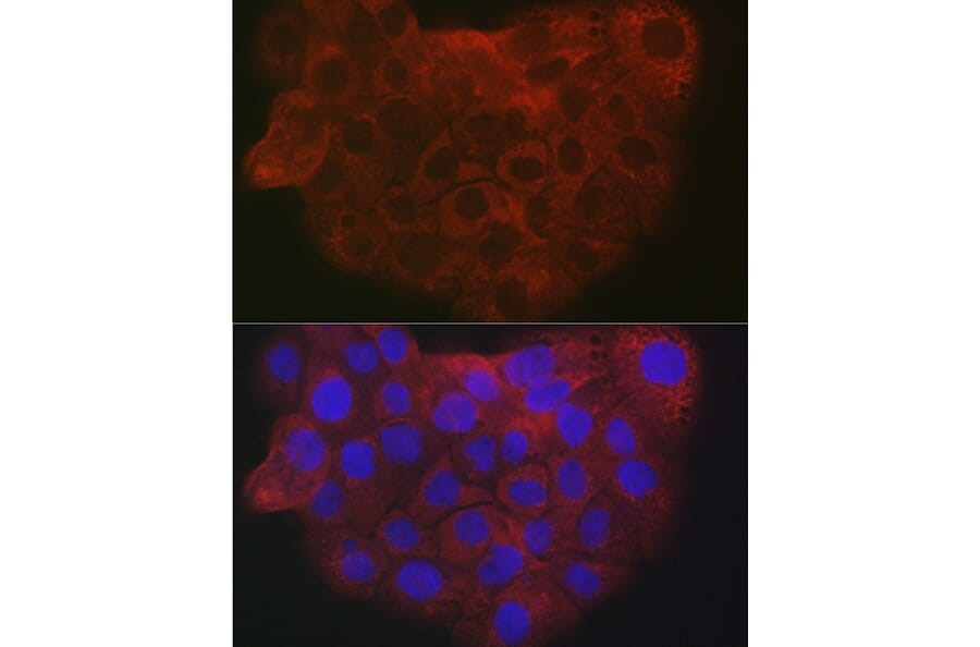 Immunofluorescence - Anti-COL1A2 Antibody (A17214) - Antibodies.com