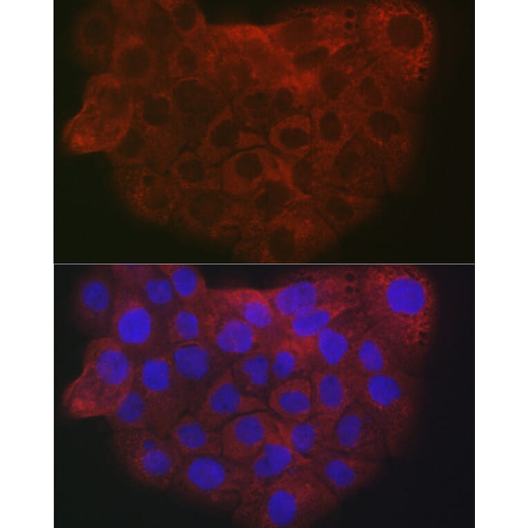 Immunofluorescence - Anti-COL1A2 Antibody (A17214) - Antibodies.com