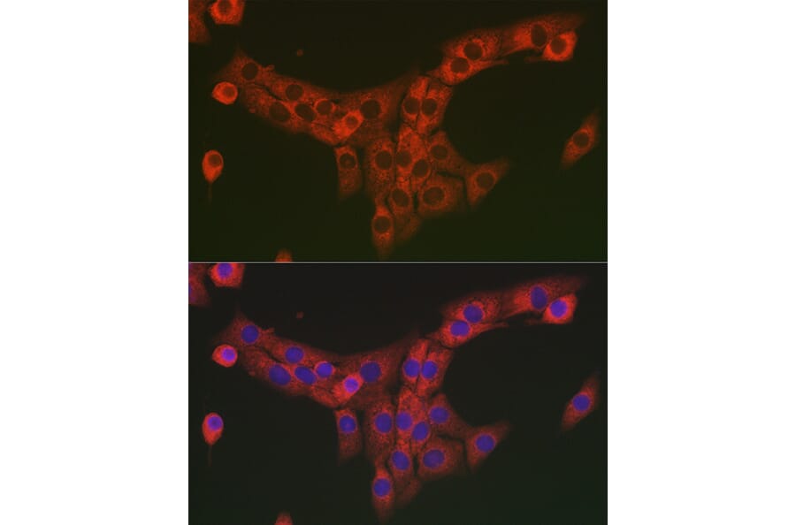 Immunofluorescence - Anti-COL1A2 Antibody (A17214) - Antibodies.com