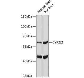 Western Blot - Anti-CYP2J2 Antibody (A17216) - Antibodies.com