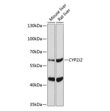 Western Blot - Anti-CYP2J2 Antibody (A17216) - Antibodies.com