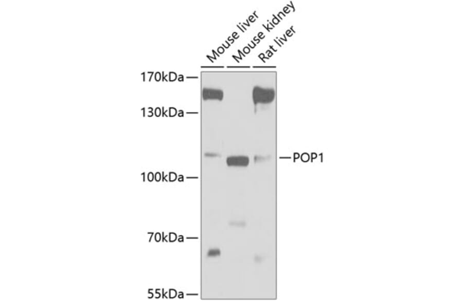 Western Blot - Anti-POP1 Antibody (A17217) - Antibodies.com
