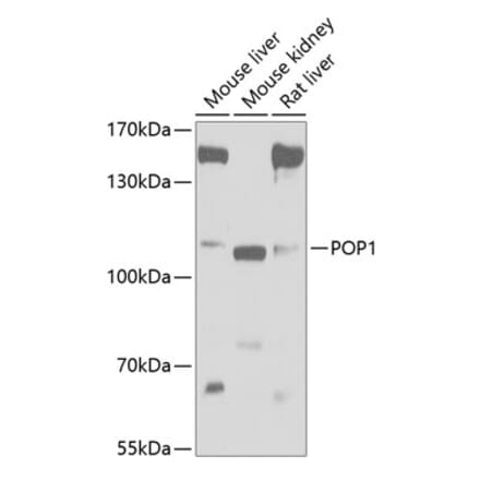 Western Blot - Anti-POP1 Antibody (A17217) - Antibodies.com