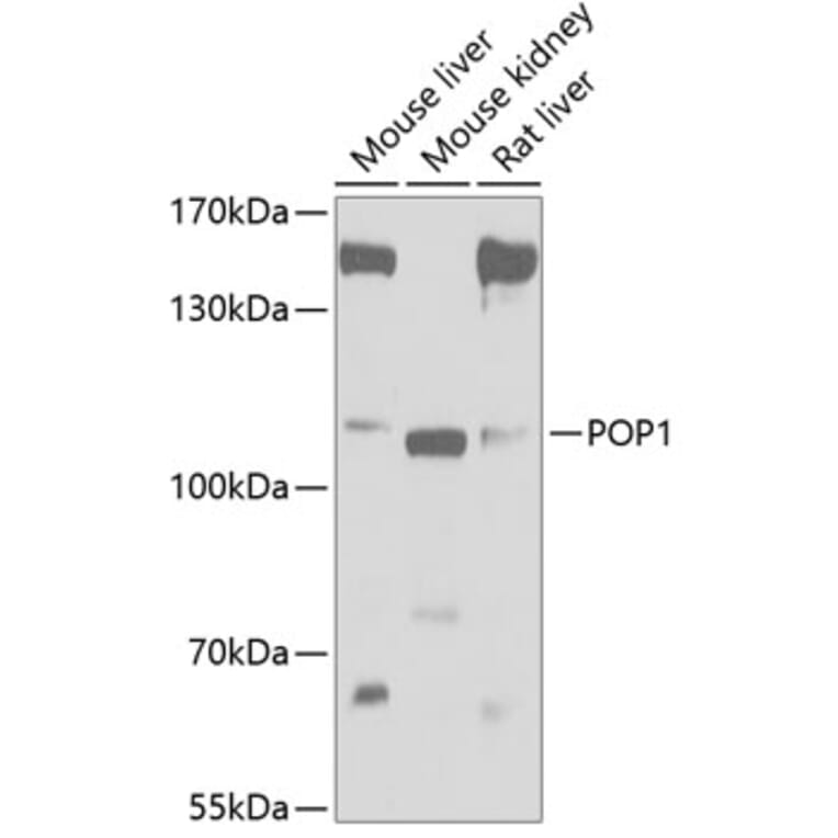 Western Blot - Anti-POP1 Antibody (A17217) - Antibodies.com