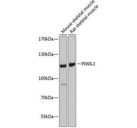 Western Blot - Anti-PIWIL2 Antibody (A17218) - Antibodies.com