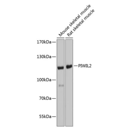 Western Blot - Anti-PIWIL2 Antibody (A17218) - Antibodies.com