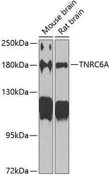 Western blot analysis of extracts of various cell lines, using Anti-TNRC6A Antibody (A6115) at 1:1,000 dilution.
Secondary antibody: Goat Anti-Rabbit IgG (H+L) (HRP) (AS014) at 1:10,000 dilution.
Lysates / proteins: 25µg per lane.
Blocking buffer: 3% non-fat dry milk in TBST.
Detection: ECL Basic Kit (RM00020).
Exposure time: 90s.