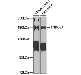 Western Blot - Anti-GW182 Antibody (A17219) - Antibodies.com