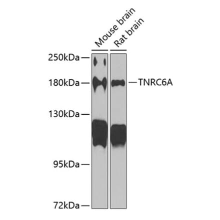 Western Blot - Anti-GW182 Antibody (A17219) - Antibodies.com