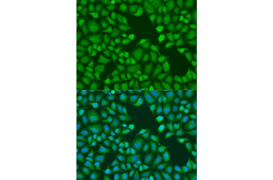 Immunofluorescence - Anti-GW182 Antibody (A17219) - Antibodies.com