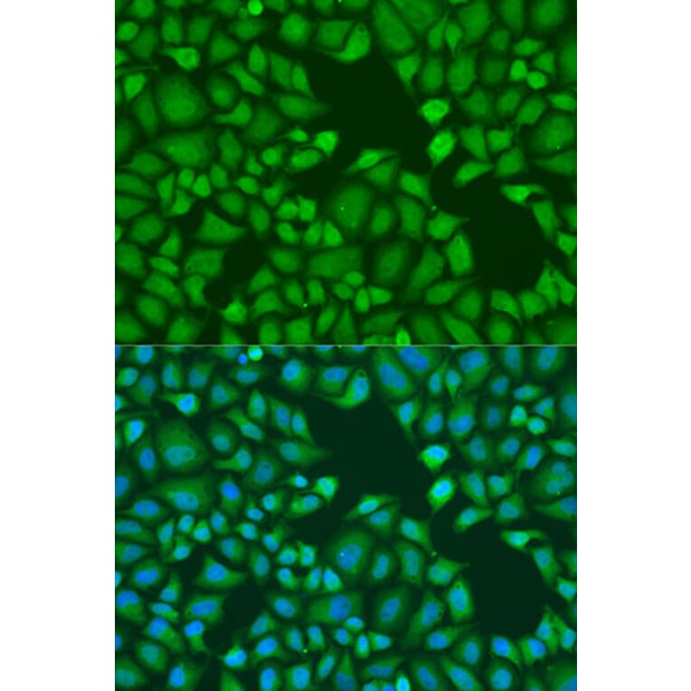 Immunofluorescence - Anti-GW182 Antibody (A17219) - Antibodies.com