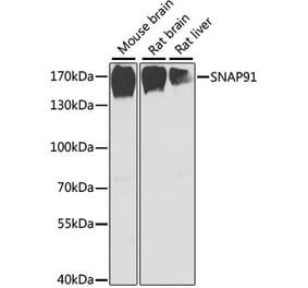 Western Blot - Anti-SNAP91 Antibody (A17220) - Antibodies.com
