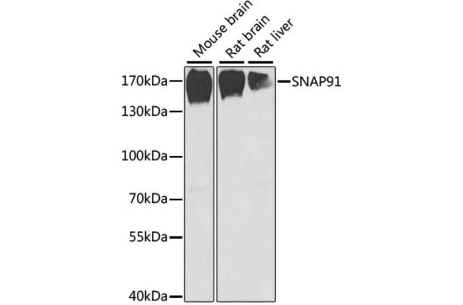 Western Blot - Anti-SNAP91 Antibody (A17220) - Antibodies.com