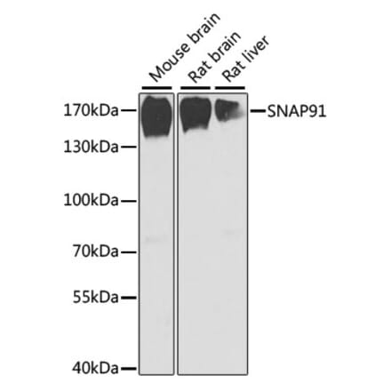 Western Blot - Anti-SNAP91 Antibody (A17220) - Antibodies.com