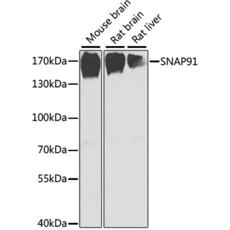 Western Blot - Anti-SNAP91 Antibody (A17220) - Antibodies.com
