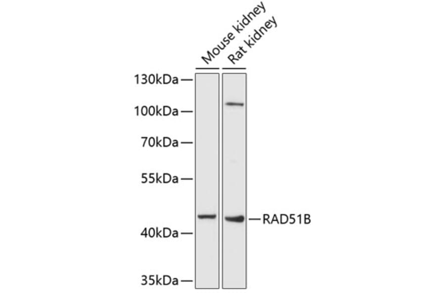 Western Blot - Anti-Rad51L1/RAD51B Antibody (A17221) - Antibodies.com