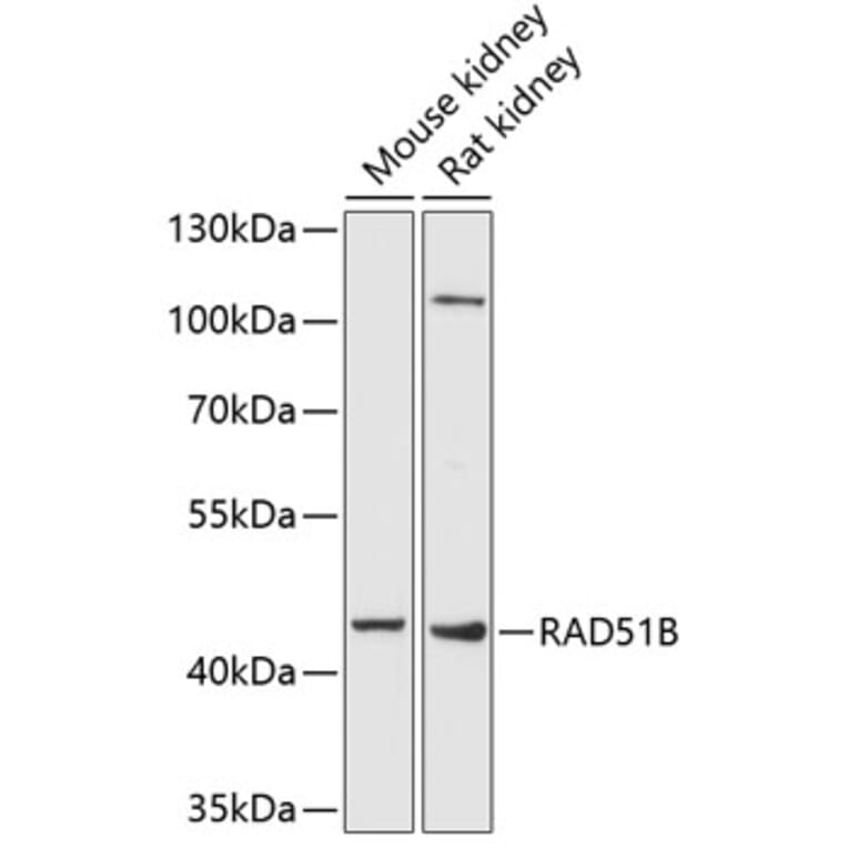 Western Blot - Anti-Rad51L1/RAD51B Antibody (A17221) - Antibodies.com