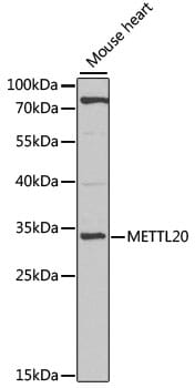 Western blot analysis of extracts of mouse heart, using Anti-METTL20 Antibody (A7152) at 1:1,000 dilution.
Secondary antibody: Goat Anti-Rabbit IgG (H+L) (HRP) (AS014) at 1:10,000 dilution.
Lysates / proteins: 25µg per lane.
Blocking buffer: 3% non-fat dry milk in TBST.
Detection: ECL Basic Kit (RM00020).
Exposure time: 90s.