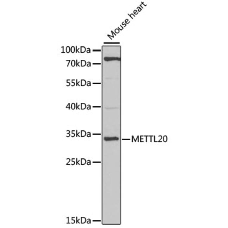 Western Blot - Anti-ETFBKMT Antibody (A17222) - Antibodies.com