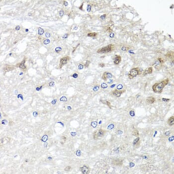 Immunohistochemistry of paraffin-embedded rat brain using Anti-METTL20 Antibody (A7152) at dilution of 1:100 (40x lens).
