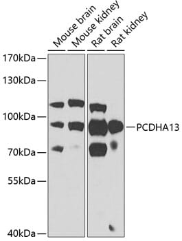 Western blot analysis of extracts of various cell lines, using Anti-PCDHA13 Antibody (A7475) at 1:1,000 dilution.
Secondary antibody: Goat Anti-Rabbit IgG (H+L) (HRP) (AS014) at 1:10,000 dilution.
Lysates / proteins: 25µg per lane.
Blocking buffer: 3% non-fat dry milk in TBST.
Detection: ECL Basic Kit (RM00020).
Exposure time: 90s.