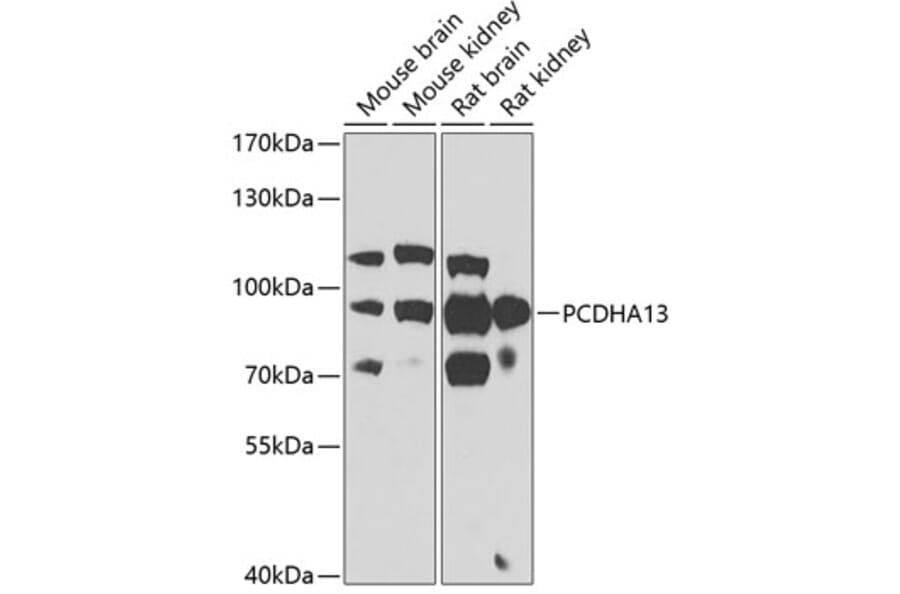 Western Blot - Anti-PCDHA13 Antibody (A17223) - Antibodies.com