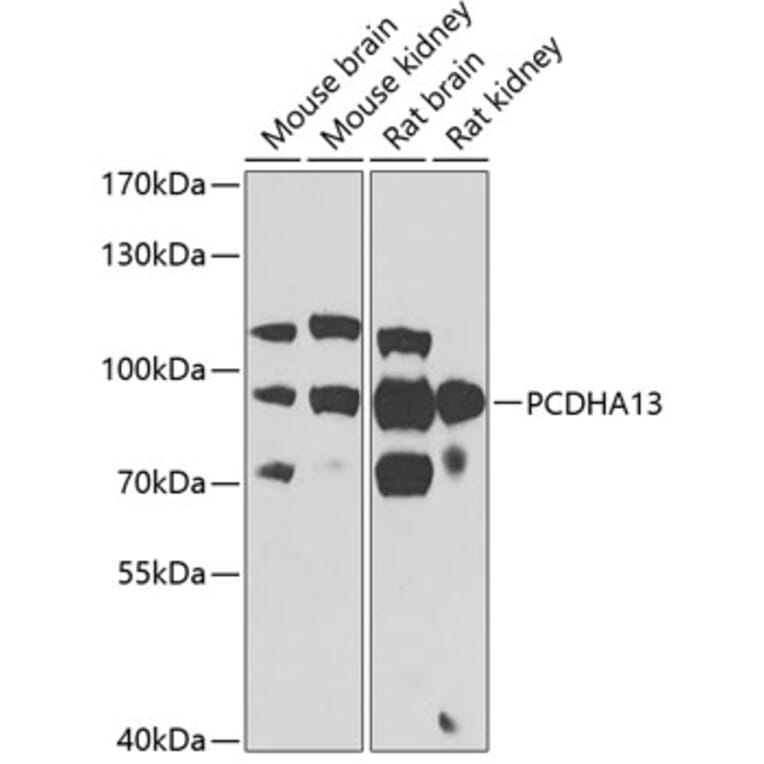 Western Blot - Anti-PCDHA13 Antibody (A17223) - Antibodies.com