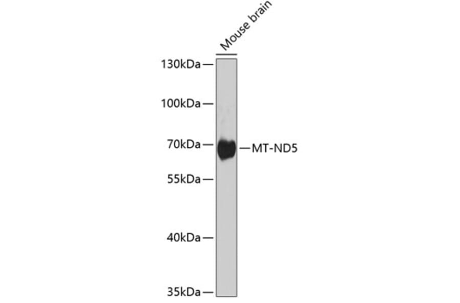 Western Blot - Anti-MT-ND5 Antibody (A17224) - Antibodies.com