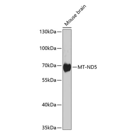 Western Blot - Anti-MT-ND5 Antibody (A17224) - Antibodies.com