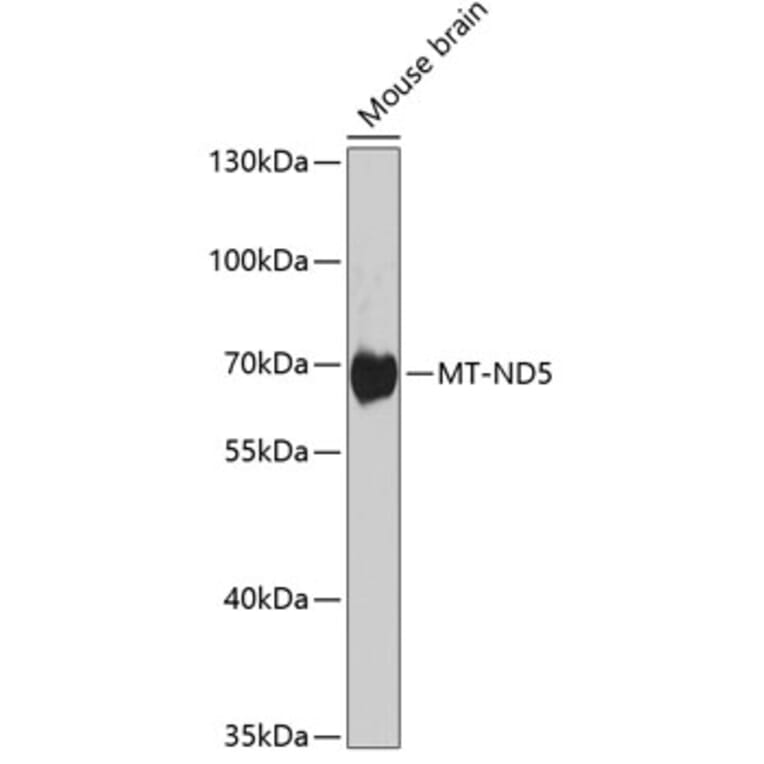 Western Blot - Anti-MT-ND5 Antibody (A17224) - Antibodies.com