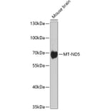 Western Blot - Anti-MT-ND5 Antibody (A17224) - Antibodies.com
