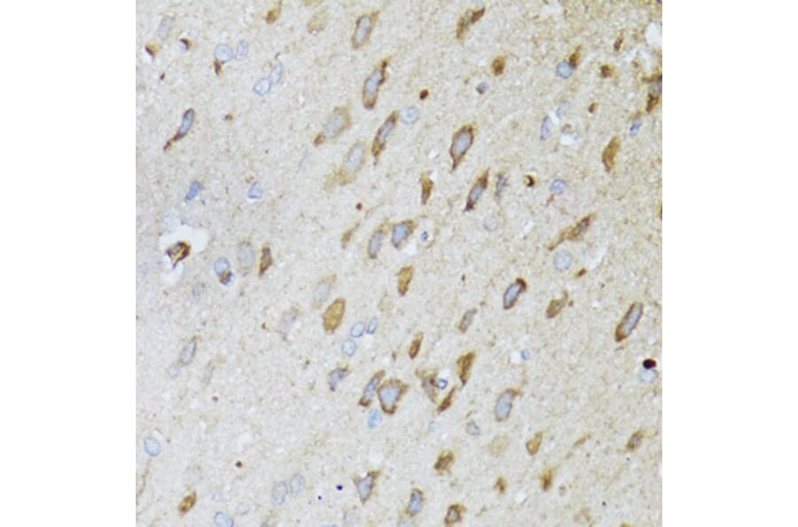 Immunohistochemistry - Anti-MT-ND5 Antibody (A17224) - Antibodies.com