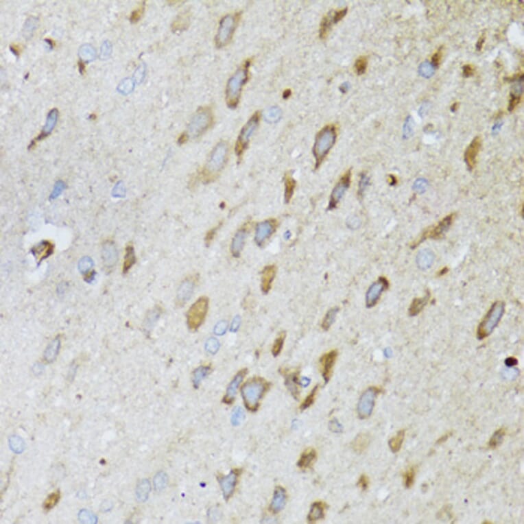 Immunohistochemistry - Anti-MT-ND5 Antibody (A17224) - Antibodies.com