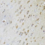Immunohistochemistry - Anti-MT-ND5 Antibody (A17224) - Antibodies.com