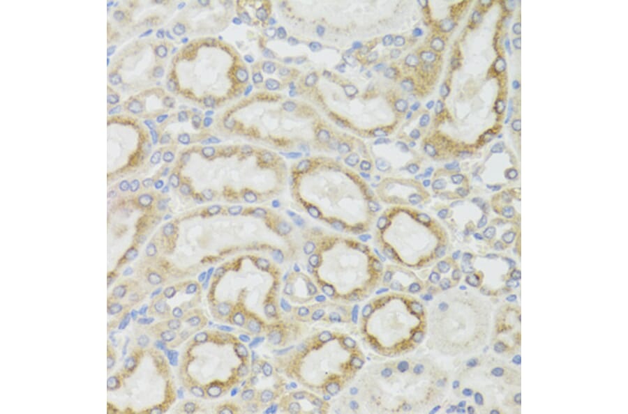 Immunohistochemistry - Anti-MT-ND5 Antibody (A17224) - Antibodies.com