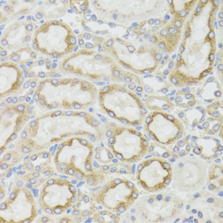 Immunohistochemistry - Anti-MT-ND5 Antibody (A17224) - Antibodies.com