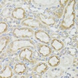 Immunohistochemistry - Anti-MT-ND5 Antibody (A17224) - Antibodies.com