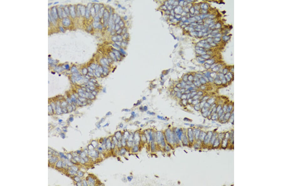 Immunohistochemistry - Anti-MT-ND5 Antibody (A17224) - Antibodies.com